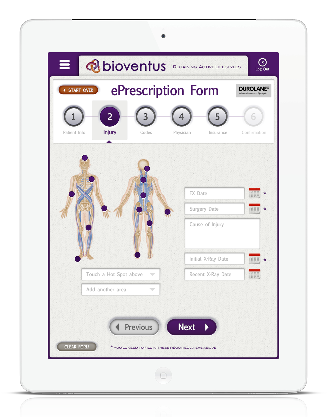 bioventus_0003_Step2_Injury